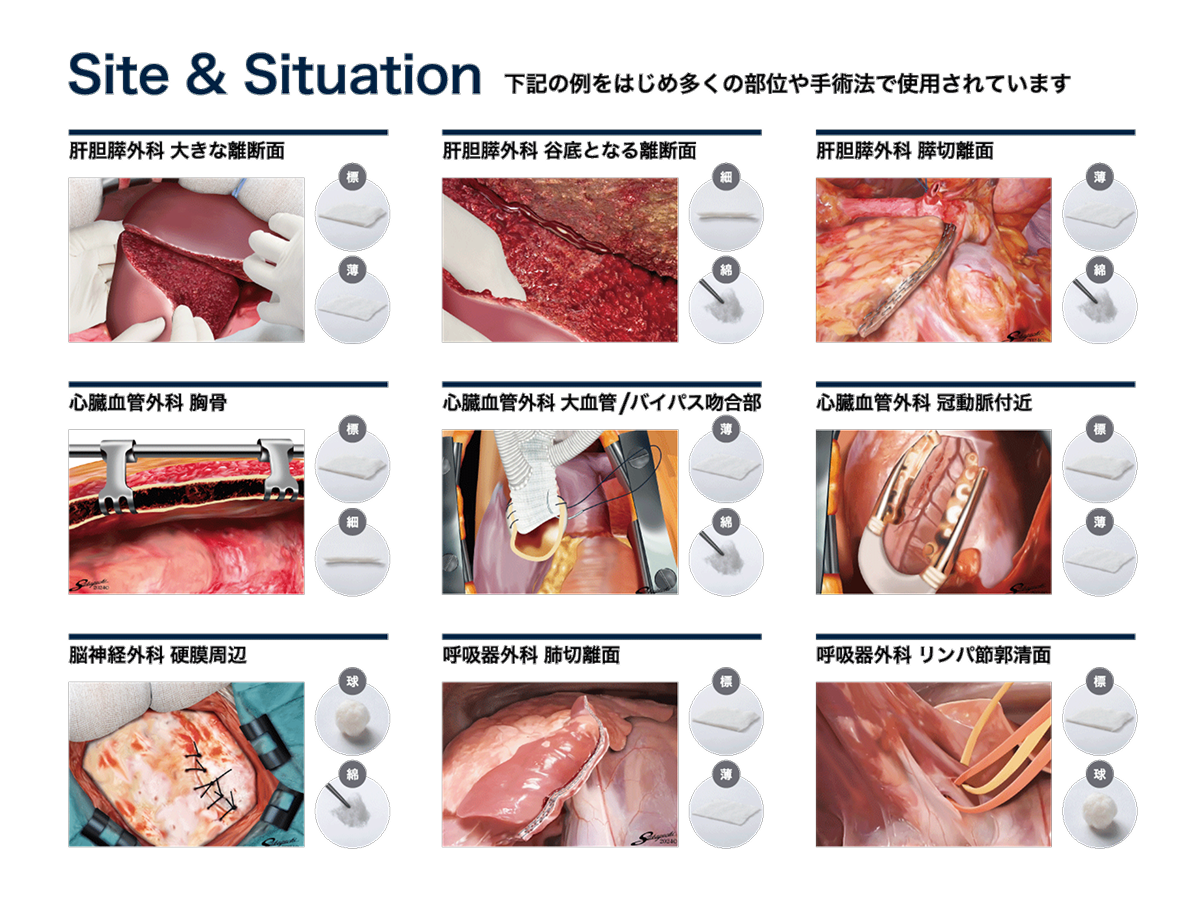 ibs irritable bowel syndrome　輸入盤　サイン入り ibs irritable bowel syndrome 輸入盤 サイン入り 大人女性の